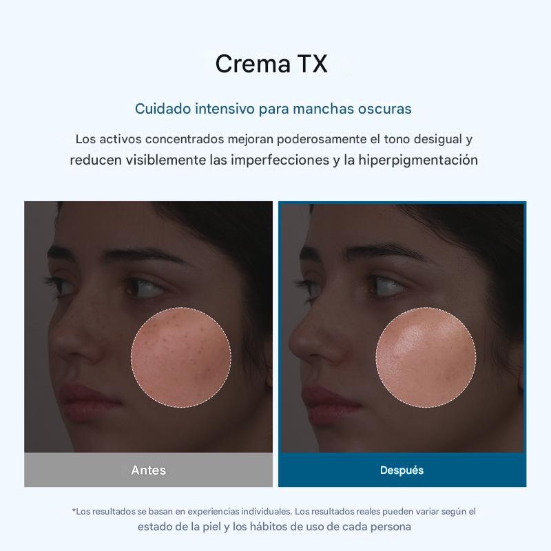 Crema Facial Despigmentante – Reduce Manchas y Unifica el Tono Infinite Love