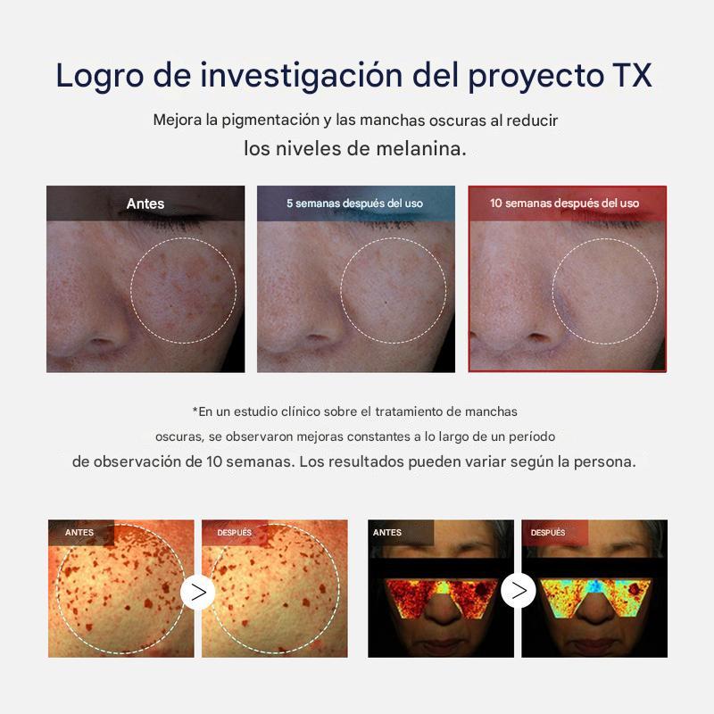 Crema Facial Despigmentante – Reduce Manchas y Unifica el Tono Infinite Love